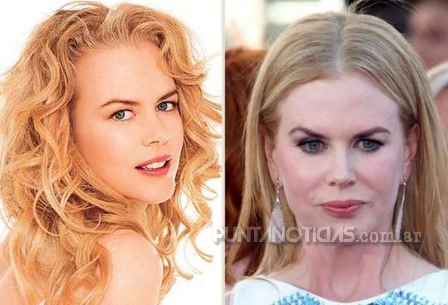 Nicole Kidman, un antes y después para el lamento